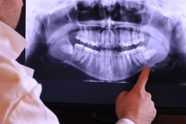 Best Emergency Wisdom Teeth Removal in Williamson, WV