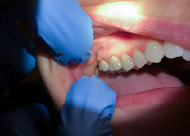 Best Emergency Broken Tooth Repair in Williamson, WV